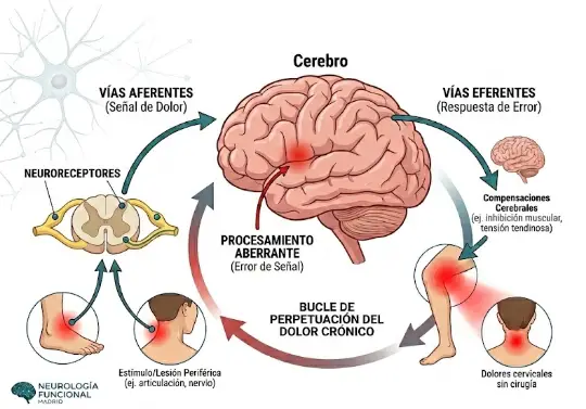 Cómo procesa el cerebro el dolor cónico
